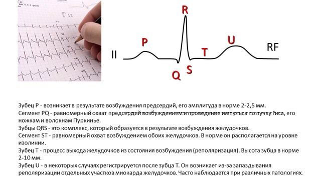 ЭКГ аудио часть 1.wmv смотреть онлайн