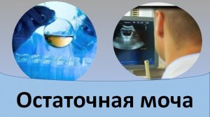 Остаточная моча.