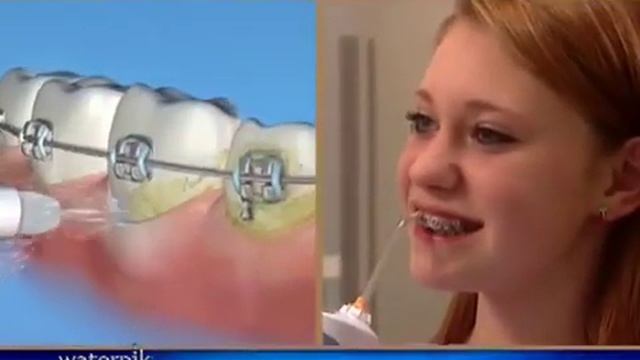 Waterpik®_Monddouches.mp4 смотреть онлайн