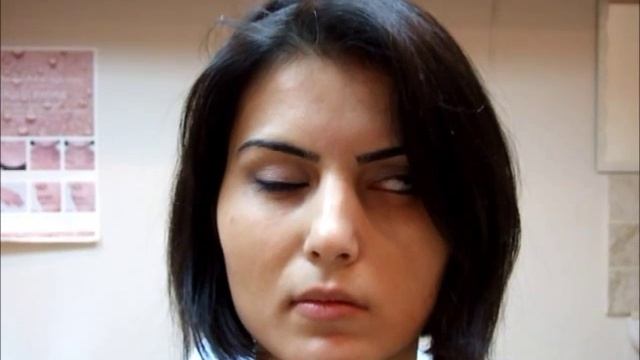 Лала - рабочая сессия 3. Неврит лицевого нерва (паралич Белла) на фоне шванномы. Микродвижения. смотреть онлайн