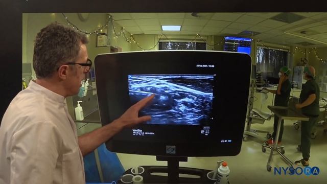Interscalene Catheter In A Patient With Difficult Anatomy - Crash Course With Dr. Hadzic