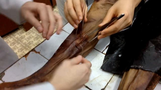 Топографическая анатомия (узлы) хирург- Max смотреть онлайн