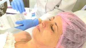 Треугольник молодости, как омолодить лицо, убрать брыли, подтянуть подбородок, лифтинг скул.