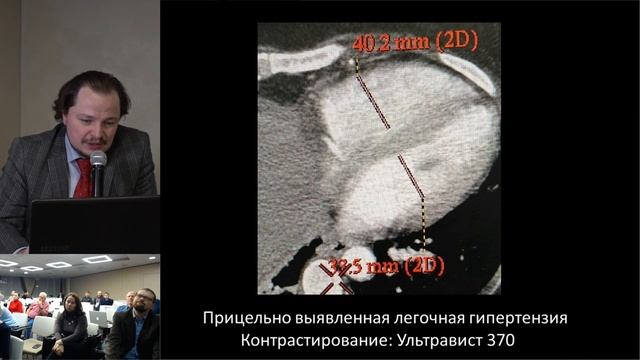 Агеев А.Н. Случайные находки при выполнении КТ и МРТ: сосуды. смотреть онлайн