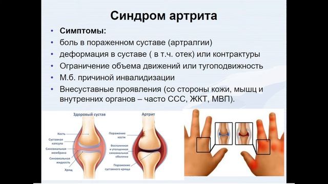 9:50 Анатомо-физиологические особенности костно-мышечной системы у детей смотреть онлайн