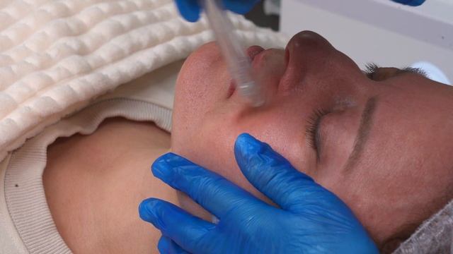 Процедура газожидкостного пилинга: подробное видео смотреть онлайн
