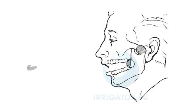 Суставные шины MRC