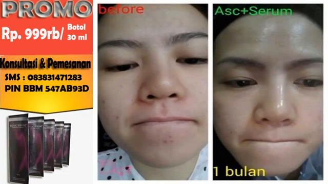 Jual Biogreen Bio SC Serum Cerahkan Kulit Samarkan Flek Original Murah Asli Indramayu 083831471283 смотреть онлайн