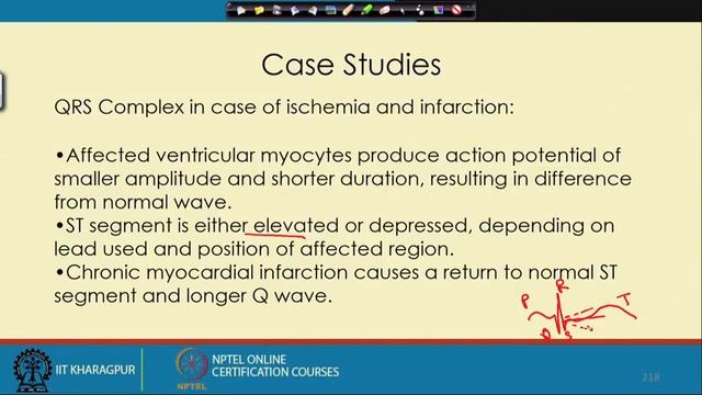 Lecture 27 : Waveform Analysis смотреть онлайн