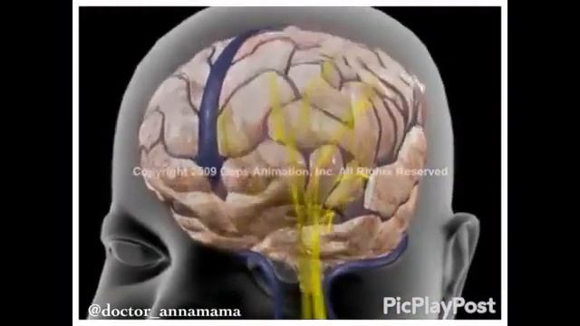СИНДРОМ ДЕТСКОГО СОТРЯСЕНИЯ. смотреть онлайн