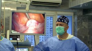 Рак. Жизнь после удаления матки и яичников. Здоровье. Фрагмент выпуска от 27.11.2016