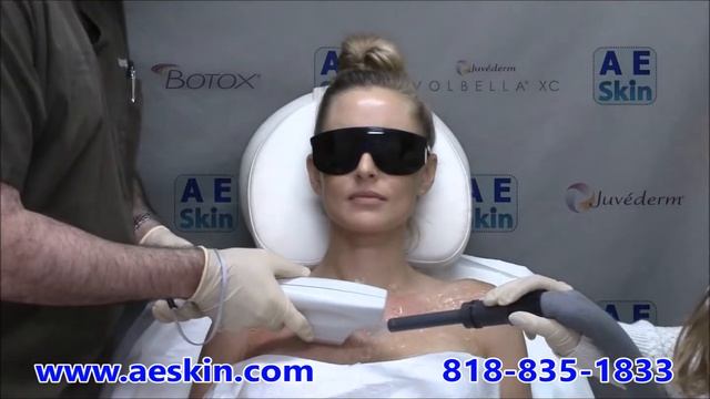 Forever Young BBL IPL Photofacial Demonstration 23 Chest - A E Skin - Encino, CA - 818-835-1833 смотреть онлайн