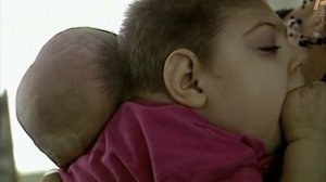 Дети-мутанты Чернобыля