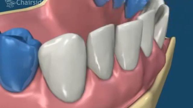 Ортодонтія, брекети, вирівнювання зубів смотреть онлайн