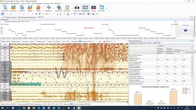 Нейрон-Спектр.NET: Полисомнография смотреть онлайн