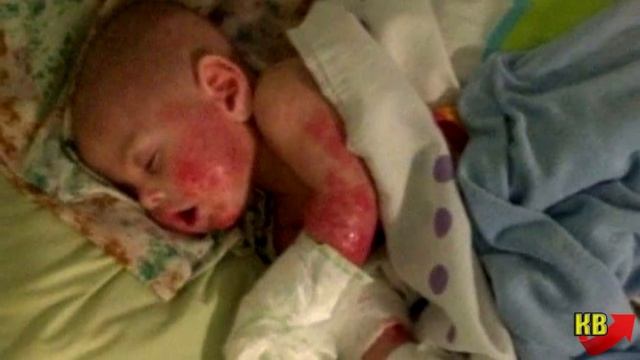 Малыш не плакал только в воде. В слезах, дни напролет мама проводила с сыном в ванной, пока он ... смотреть онлайн