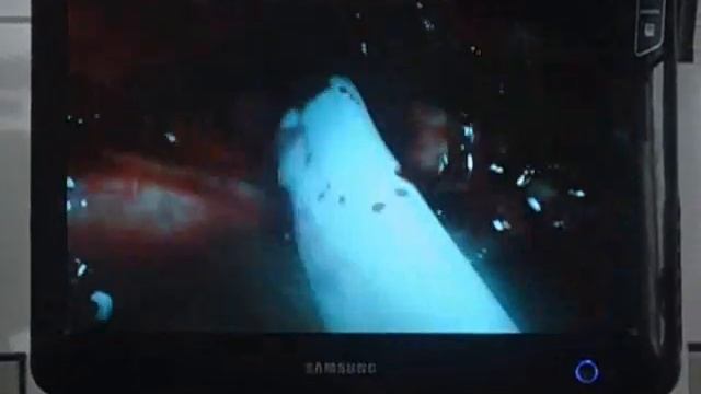 Панкреонекроз Дергачівська ЦРЛ