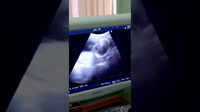 Моя первая в жизни видеосъемка. Ухо чешется смотреть онлайн