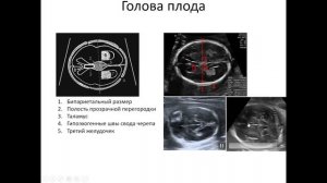 УЗИ плода во  2-3 триместрах.  Часть 1. 2022 05 13 13 14 07