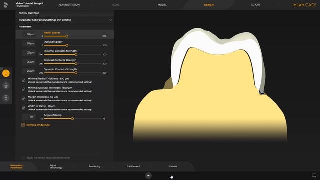 Primeprint Solution Workflow to create temporaries labside (en) смотреть онлайн