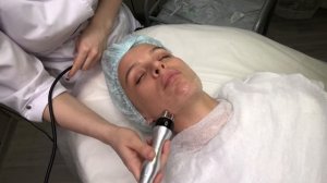 Rf-лифтинг, моя любимая процедура.