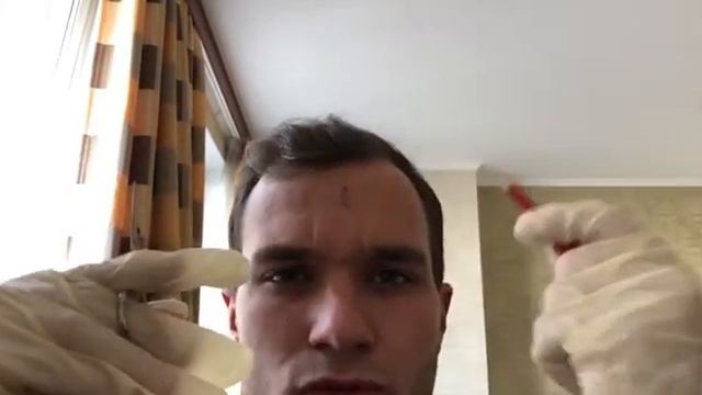 Как правильно снимать швы с лица смотреть онлайн