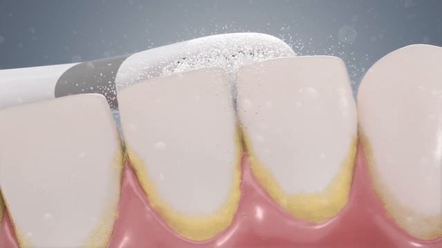 The Technology behind the Colgate® ProClinical® A1500 Electric Toothbrush смотреть онлайн