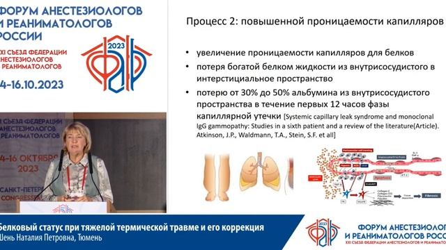 Белковый статус при ожогах Шень Н.П. смотреть онлайн