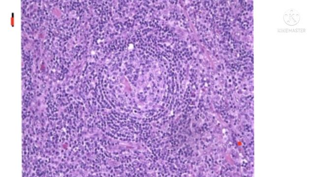 SSIMS First year postgraduate students of Pathology /Histology Lymphnode Recap Basics(PART 1) смотреть онлайн