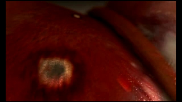 Алкоголь и печень