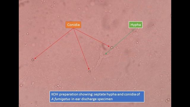 Microbiology color atlas bacteria virus fungus parasites смотреть онлайн