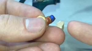 Моделировка каркаса из воска под металлокерамику (35 зуб)