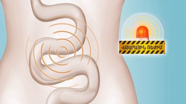 Imodium - Իմոդիում