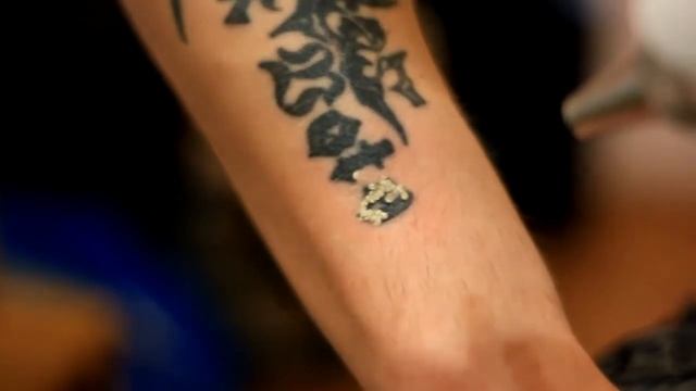 Удаление татуировки. смотреть онлайн