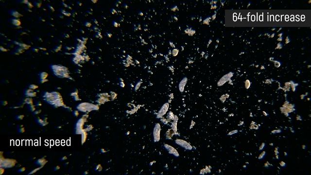 The Universe in a drop of water. Under the microscope // invisible world смотреть онлайн