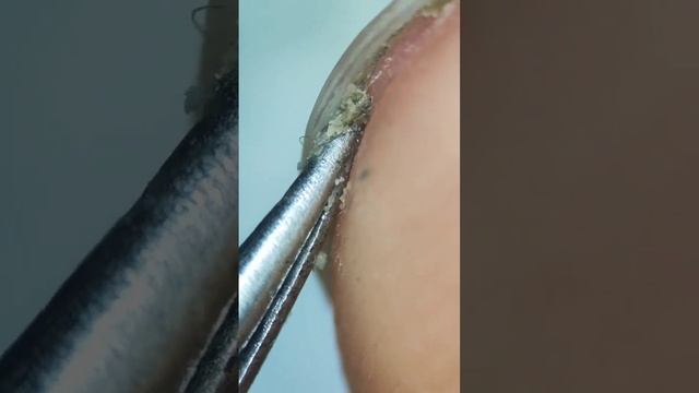 НОГТИ ПОД МИКРОСКОПОМ смотреть онлайн