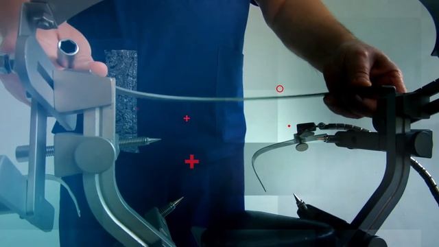 Хирургический комплекс КОМПАС. смотреть онлайн