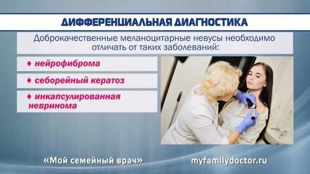Родинки на теле и лице: причины появления, удаление смотреть онлайн