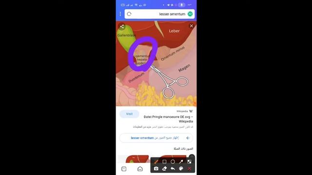 Anatomy GIT "stomach revision" смотреть онлайн