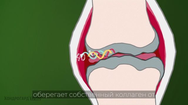 Как сохранить здоровье суставов и спины. Хондрогард Трио
