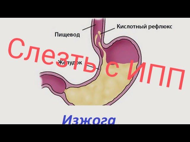 ГЭРБ. Как слезть с ИПП. Ремиссия и выздоровление