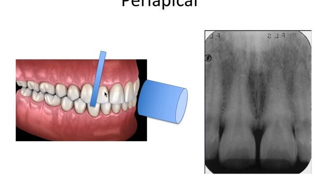 How to Read Dental X-Rays смотреть онлайн