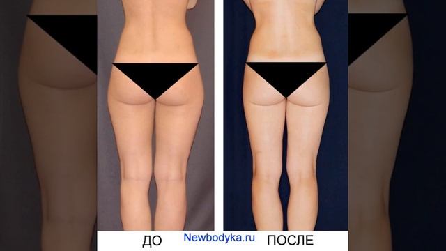 КОРРЕКЦИЯ ФИГУРЫ ПОХУДЕНИЕ. УБИРАЕМ ПОПИНЫ УШИ. смотреть онлайн