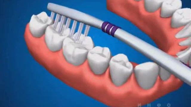 Гигиена на нижней челюсти смотреть онлайн