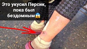 Укусил Бабушку♀️когда свободно бегал. Я в Шоке