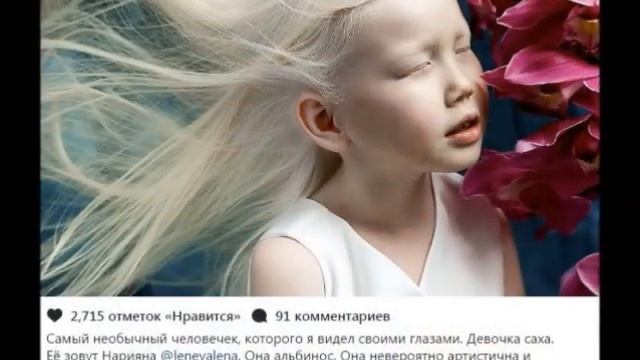 «Сибирская белоснежка» - девочка-альбинос из Якутии покоряет модельные агентства и интернет. смотреть онлайн