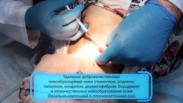 CO2 Лазер смотреть онлайн