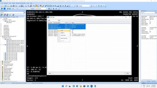 MicroDicom DICOM Viewer 2023.1