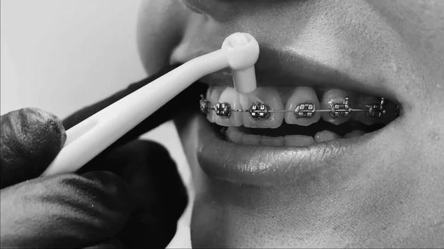 Гигиена полости рта в домашних условиях смотреть онлайн