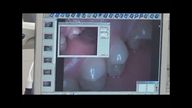 Использование видеокамер в стоматологии смотреть онлайн